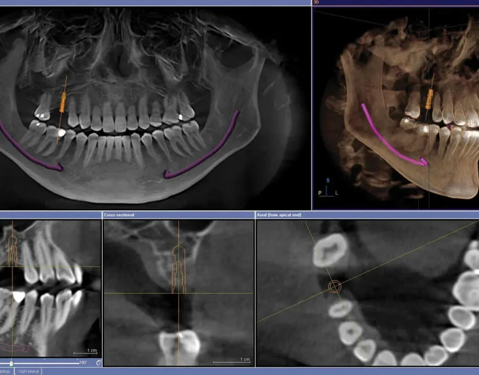 Biodent