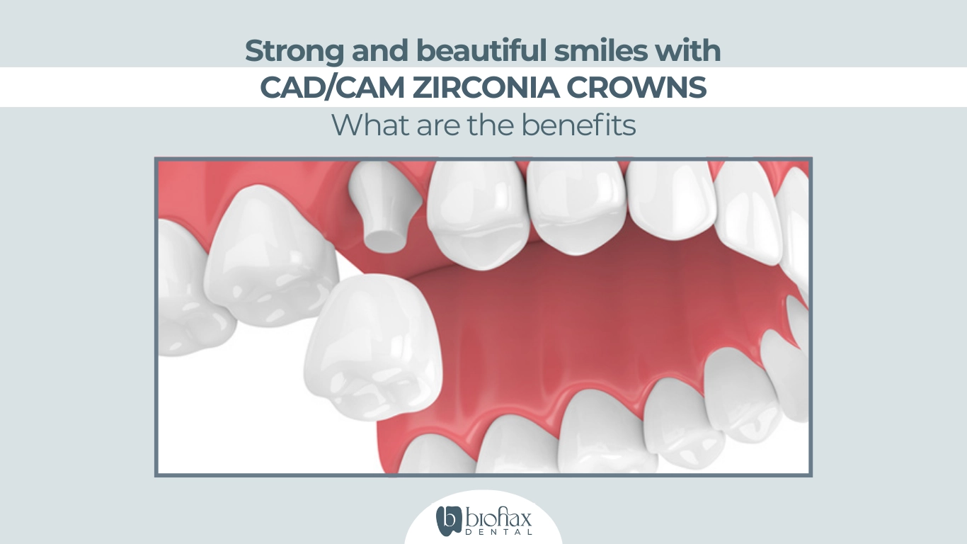 CAD/CAM Zirconia Crowns